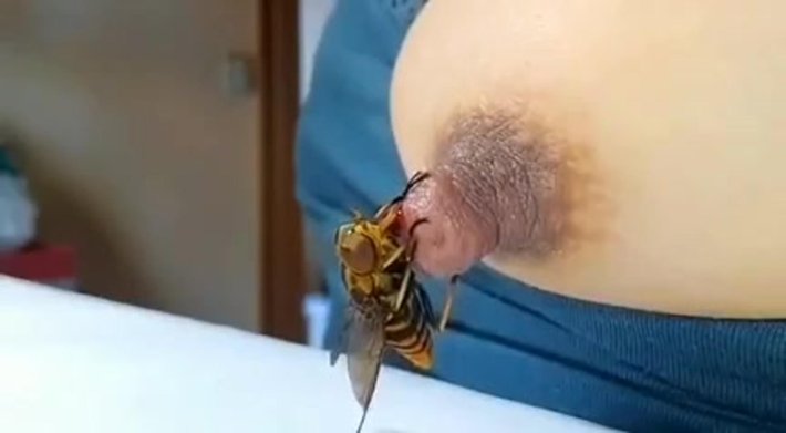 Насекомые кусают соски