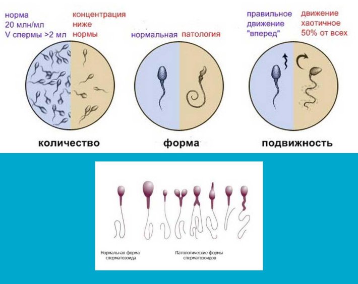 Оценка подвижности спермиев