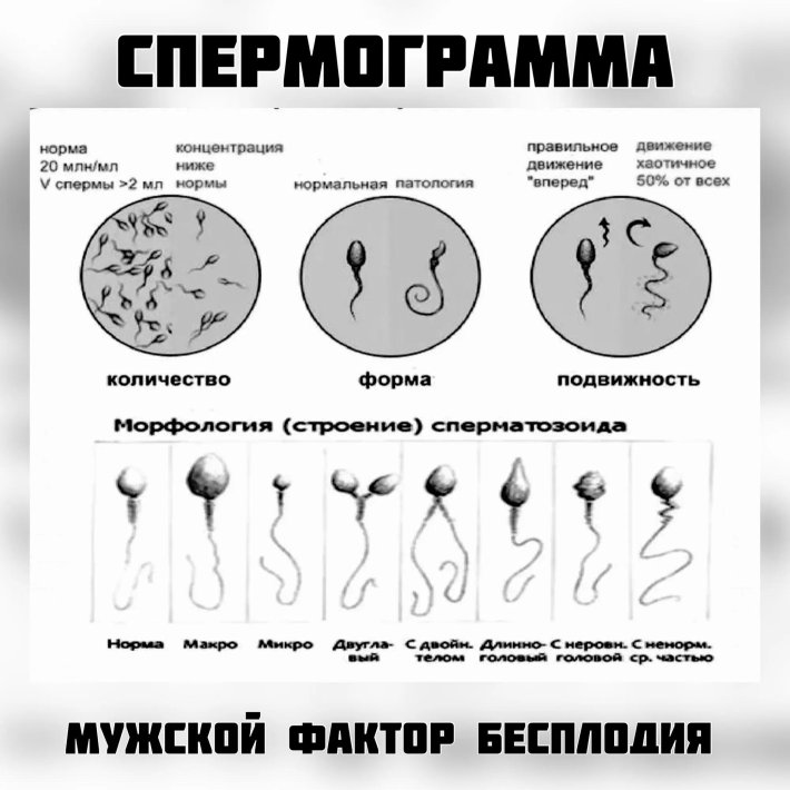 Подвижность сперматозоида