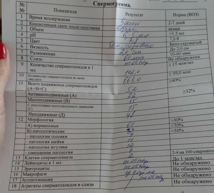 Нормальные показатели микроскопического исследования спермограммы
