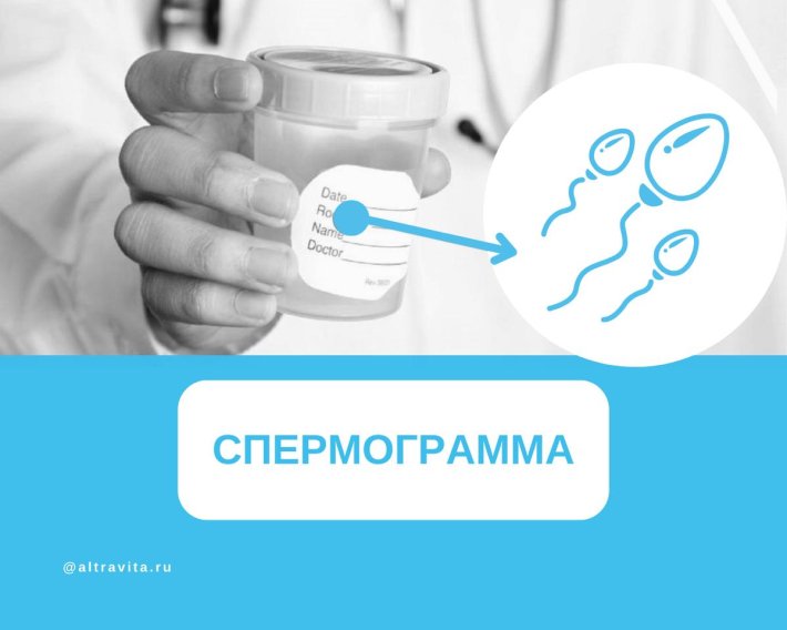 Как сдается спермограмма