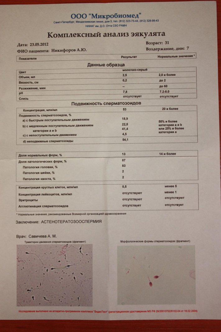 Спермограмма анализ