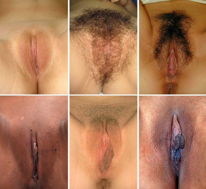 Genital estetik