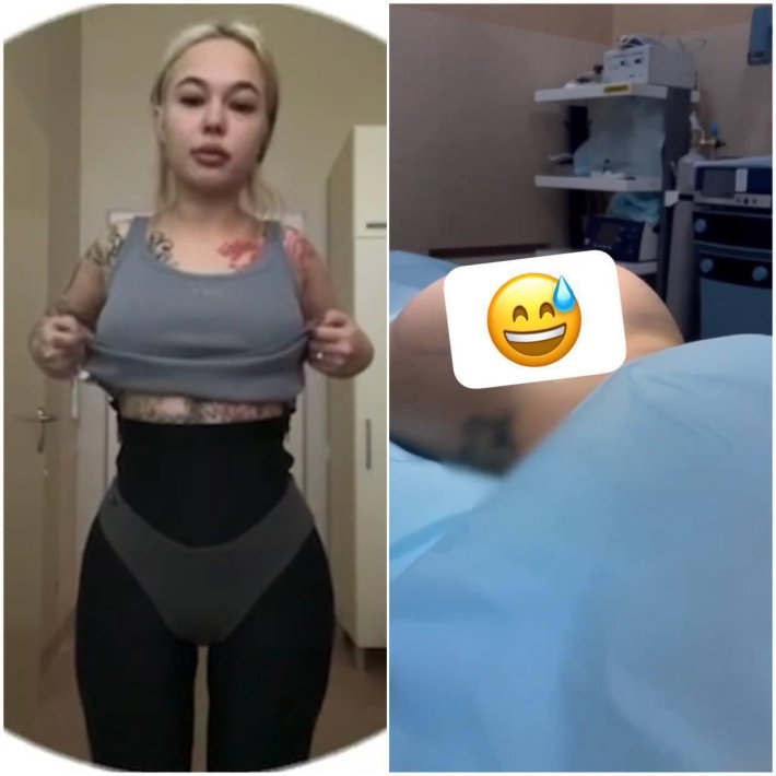 Инстасамка сделала операцию на ягодицы