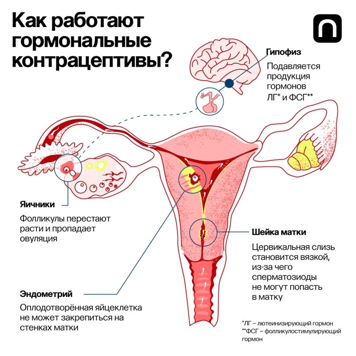 Гормональные контрацептивы