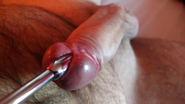 Саундинг уретры