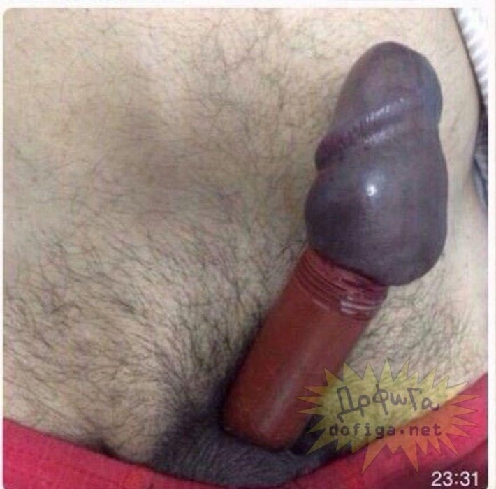 Синий перетянутый пенис