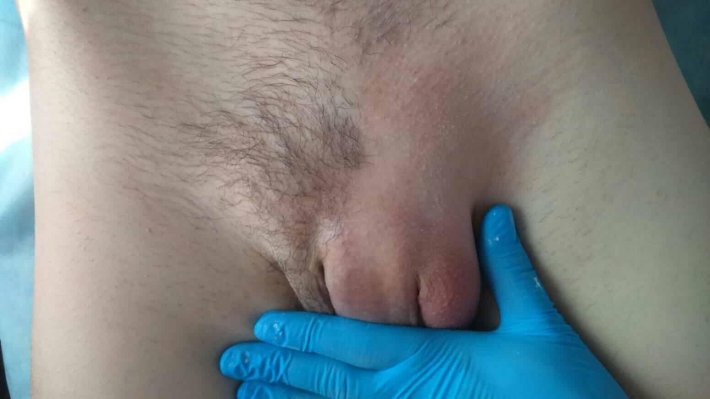 Мужская эпиляция интимных зон