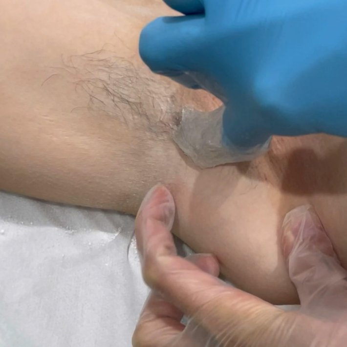 Шугаринг мужское бикини ххх