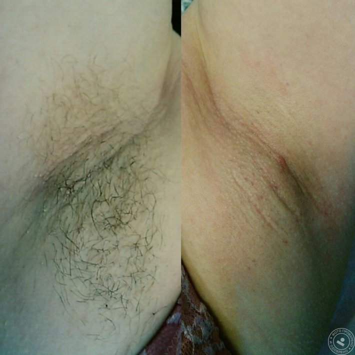 Бикини крупным планом глубокое