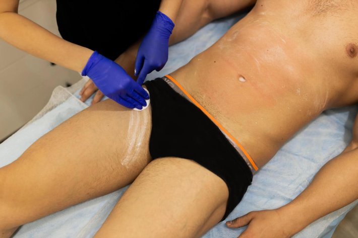 Депиляция интимной зоны мужская