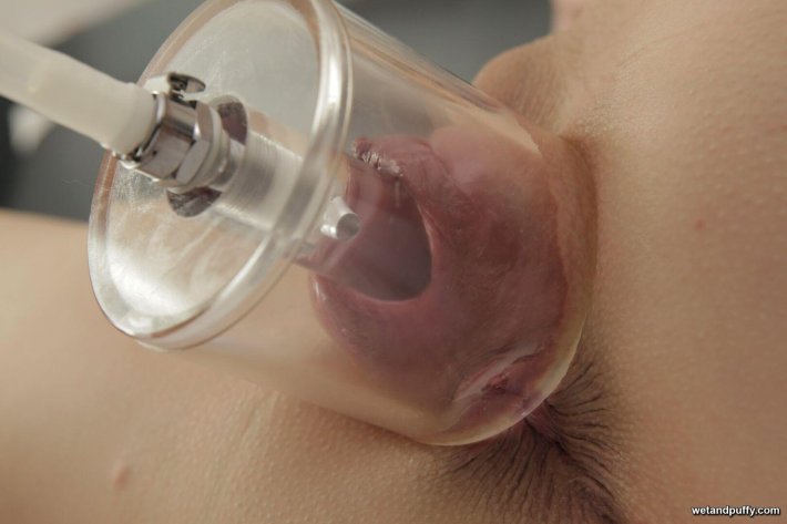 Вакуумная банка