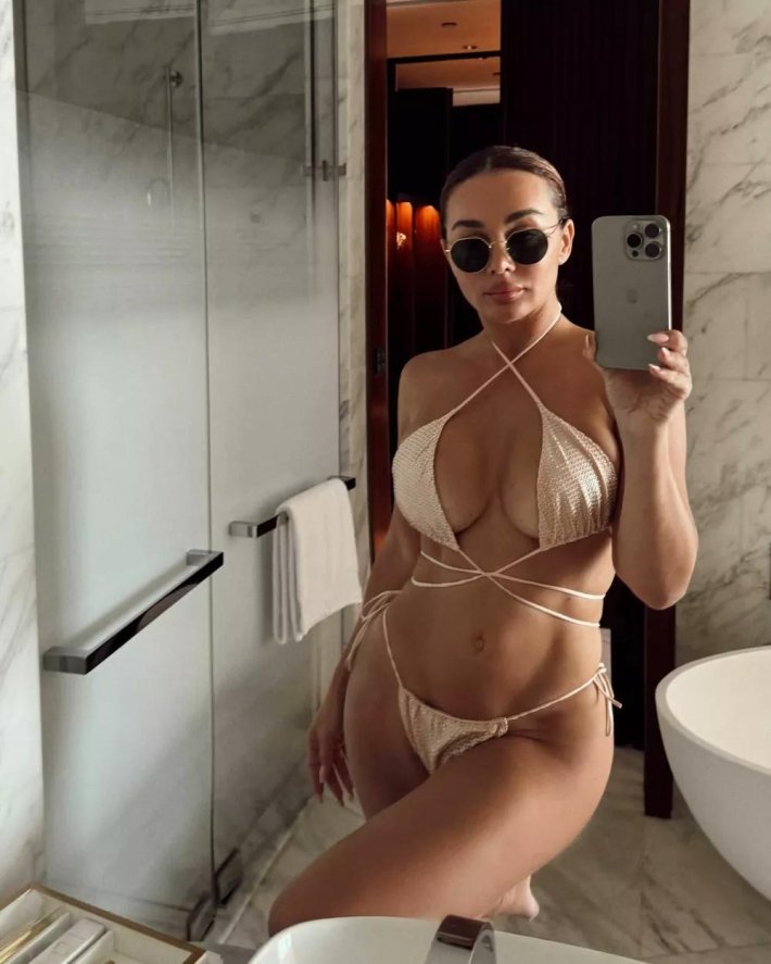 Анна седакова после пластики