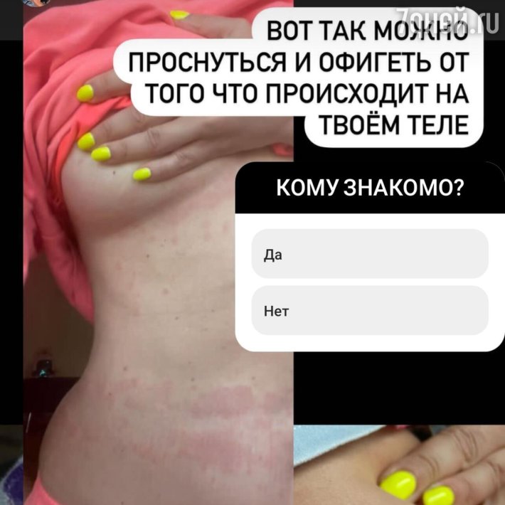 Наташа Королева слив