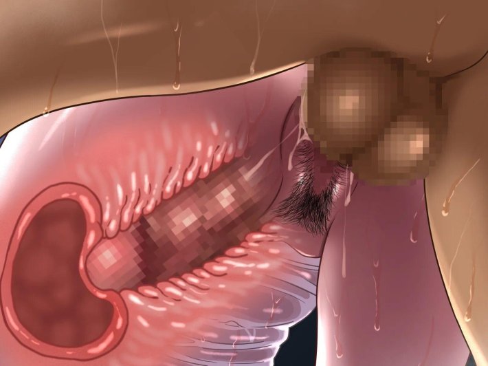 Sex xray