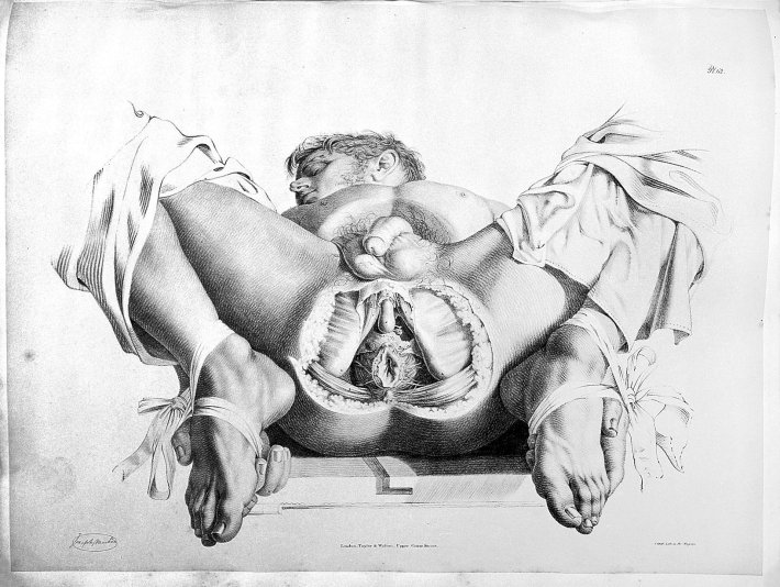 Анальный половой акт в разрезе